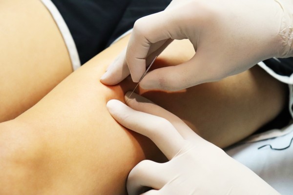 E-learning — Diagnostic et traitement du syndrome myofascial douloureux